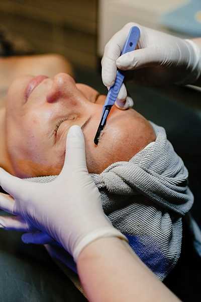 Derma Planing