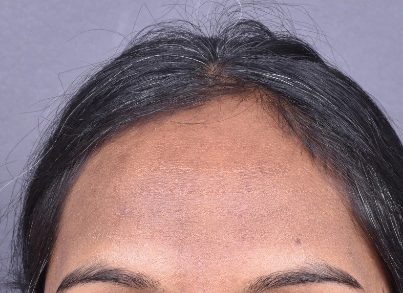 After image