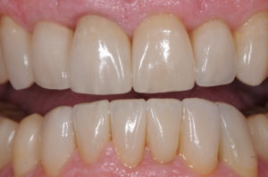 After image