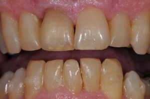 Before image