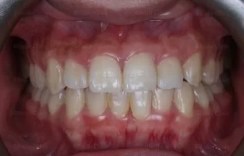 Before image