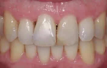 Before image